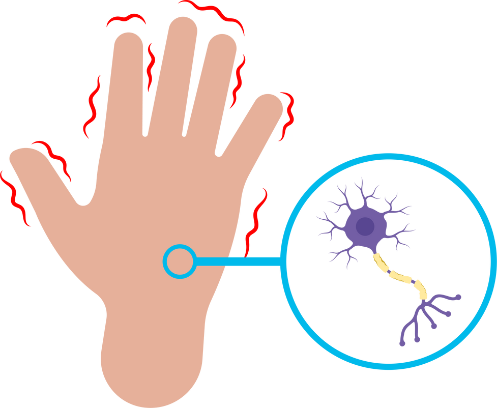 Parkinson's brain disorder nerves hand limb motor dopamine Genes genetic loss memory Alzheimer's